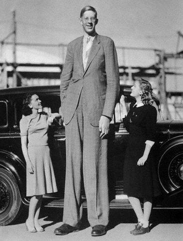 Роберт Вэдлоу - самый высокий человек в истории - 7