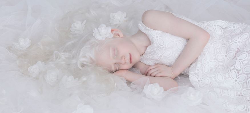 красоты альбиносов