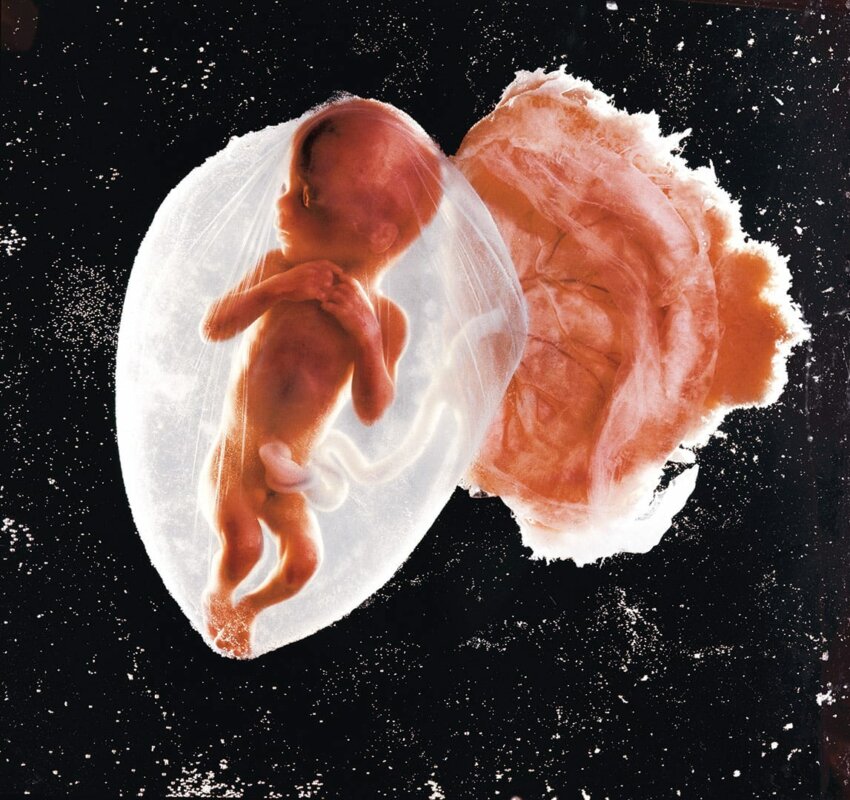 "Зародыш, 18 недель" Леннарт Нильсон
